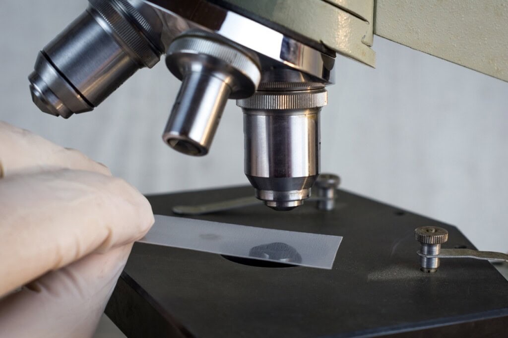 Mining, to microbes and beyond 2 2